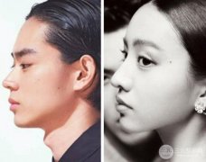 自体脂肪填充胸部要多少钱?可以维持多久? 自体脂肪填充胸部要多少钱?可以维持多久?