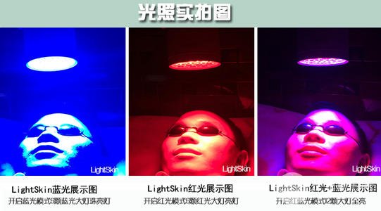 红蓝光缓解痤疮什么人不适合做
