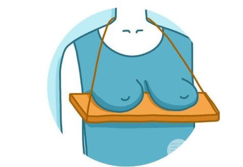 乳房下垂的原因有很多，可分为以下几类：