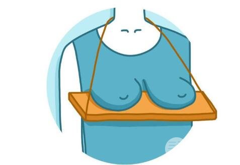 乳房下垂的原因有很多,可分为以下几类: