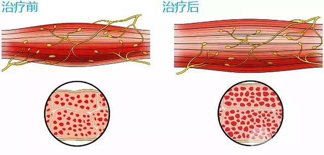 美修斯