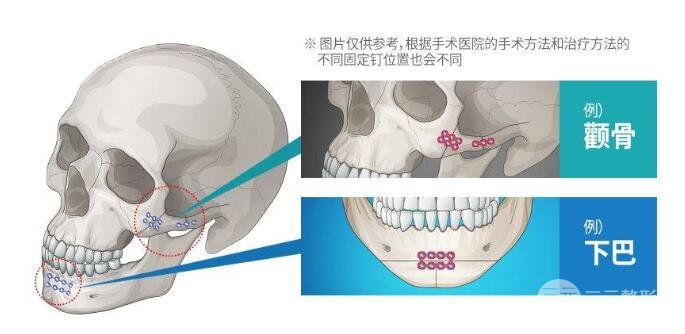 其他费用