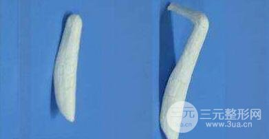 人工假体隆鼻怎么样?