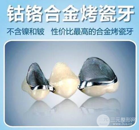 钴铬合金烤瓷牙多少钱一颗