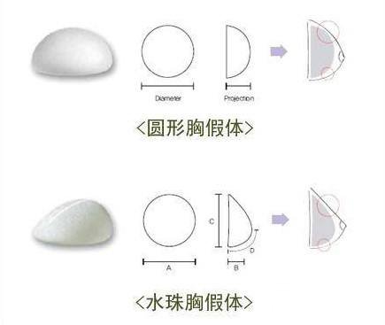 水滴型假体对比