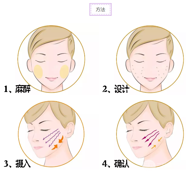 面部下垂怎么办 埋线除皱