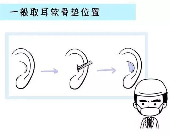 手术优点