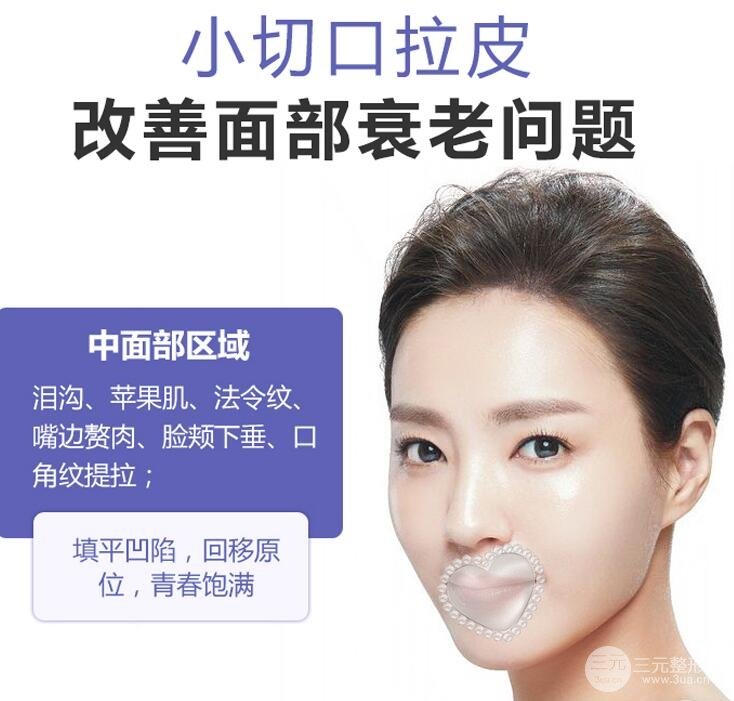 小切口面部除皱是啥