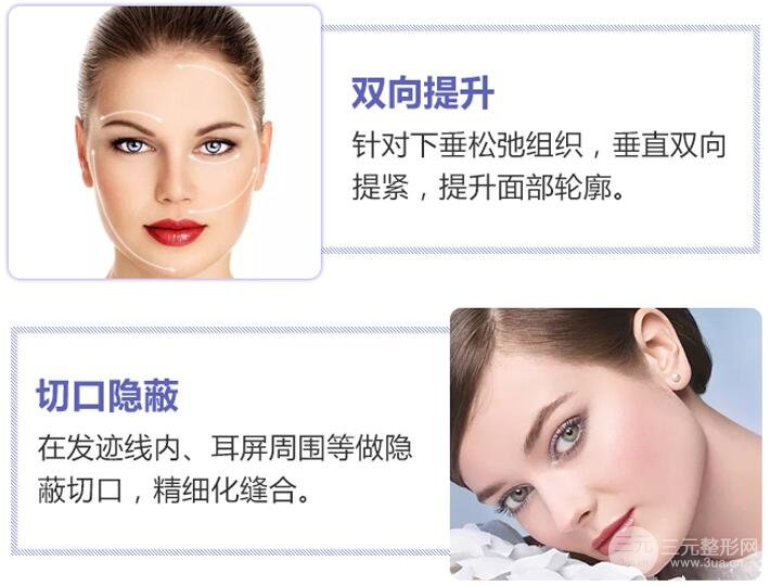 小切口面部除皱的优点