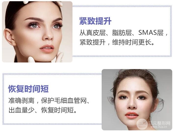 小切口面部除皱优点有哪些