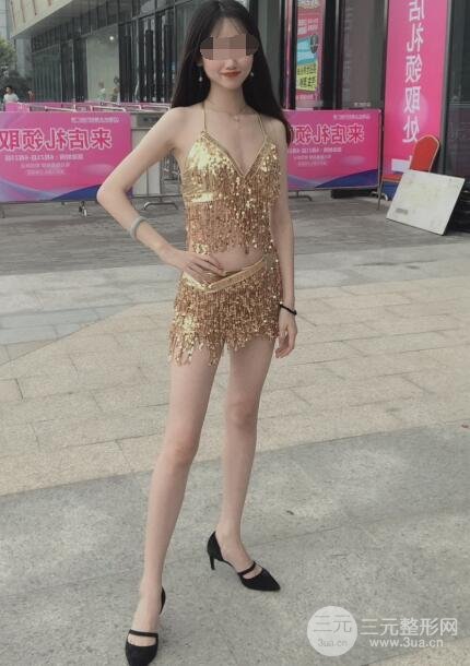 大腿吸脂案例