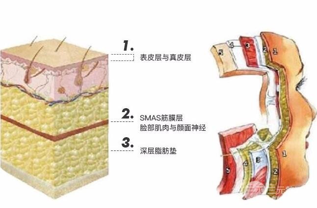 医美怎么样去法令纹