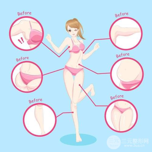 吸脂减肥手术注意事项