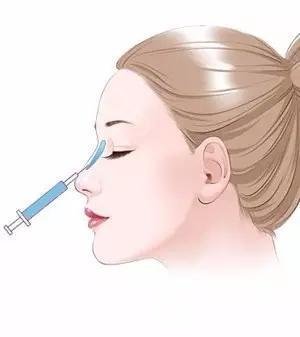 注射隆鼻和假体隆鼻有什么区别?