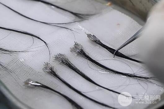 植发手术毛囊提取