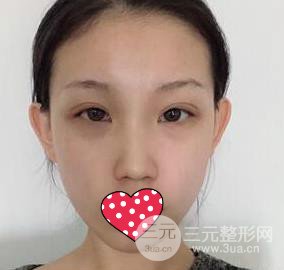北京宫国华医疗美容诊所好不好?附良好嫩肤案例