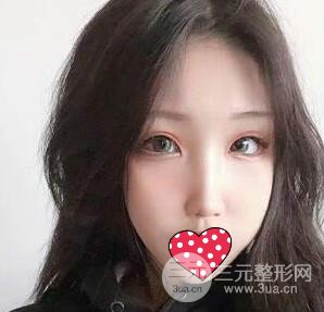 北京宫国华医疗美容诊所好不好?附良好嫩肤案例
