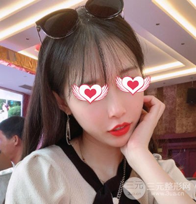 北京宫国华医疗美容诊所好不好?附良好嫩肤案例