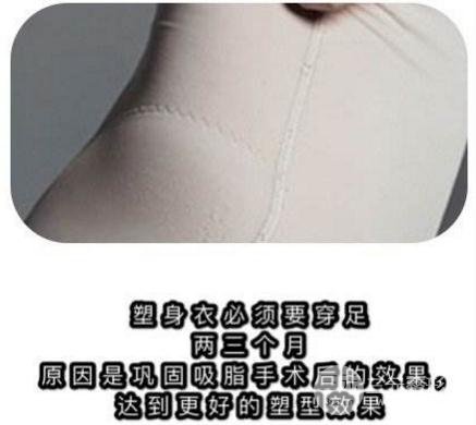 塑身衣