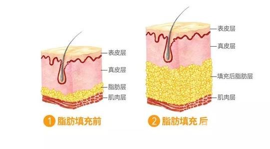 成好吗