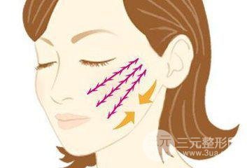 中面部除皱术后遗症有哪些
