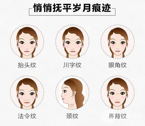 注射注射瘦脸注射除皱注意事项