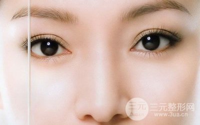 常州第一人民医院美容科割眼袋好吗？附祛眼袋案例