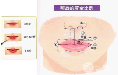 注射玻尿酸丰唇后多久可以涂口红