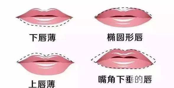 注射玻尿酸丰唇多少钱一针?