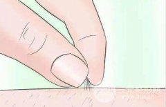 脱毛果哪种方法好？大家常用这几种哦~