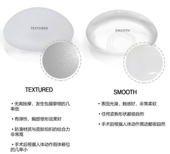 曼托隆胸假体