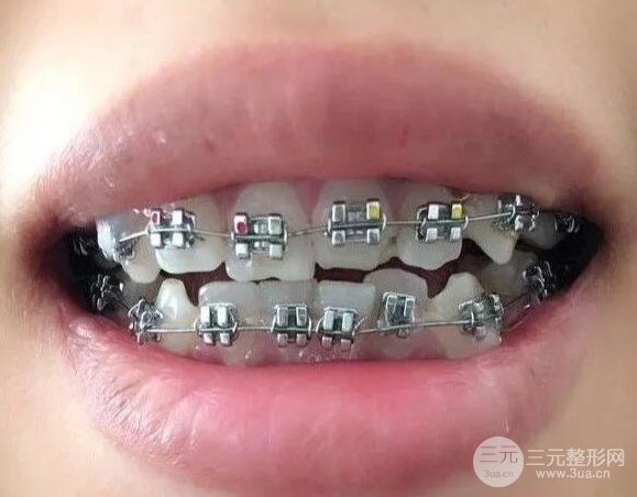 淮北中医院口腔科怎么样?让牙齿变的更加整齐漂亮！