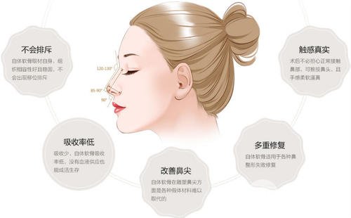 自体耳软骨隆鼻价钱是多少?