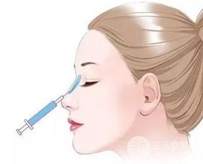 注射隆鼻成好吗