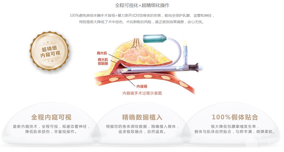 内窥镜假体隆胸手术原理
