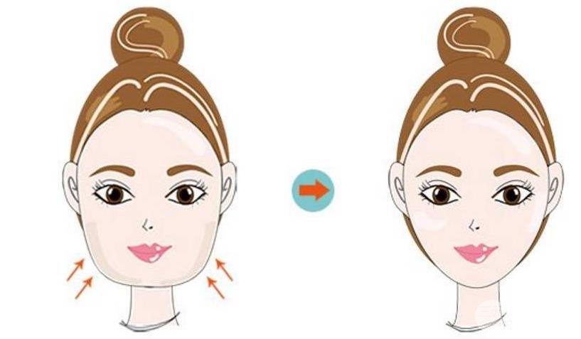 下巴吸脂多少钱