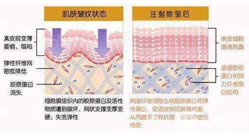 为什么有些人认为胶原蛋白很有用，但有些人认为它没用?