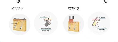 黑脸娃娃美容成好吗?