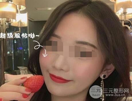 黑脸娃娃真实果术后