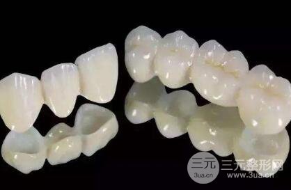 纳米烤瓷牙和全瓷牙哪个好?区别是什么?