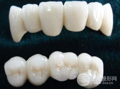 全瓷牙和纳米烤瓷牙差异：