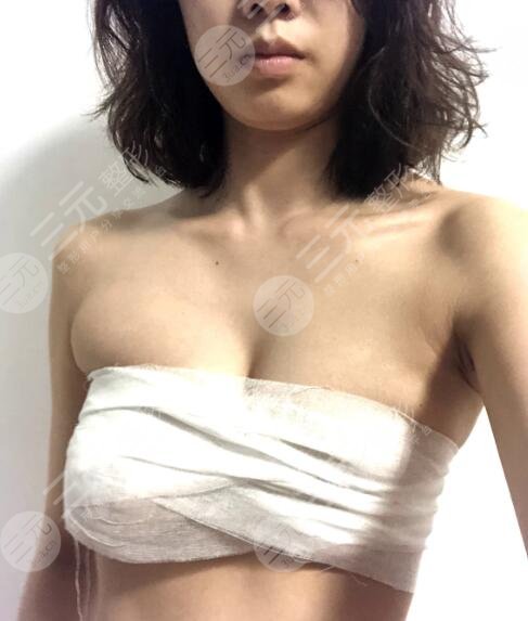 假体隆胸术后7天
