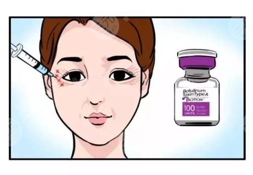 科普：眼部注射除皱的方法，一般多少钱？