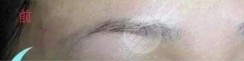 韩式纹眉案例