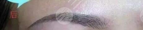 韩式纹眉案例