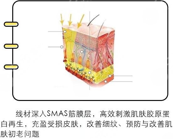 全脸埋线除皱