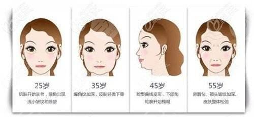 小切口拉皮除皱适合哪些人