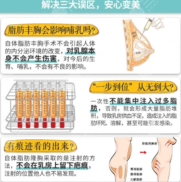 自体脂肪细胞丰胸手术