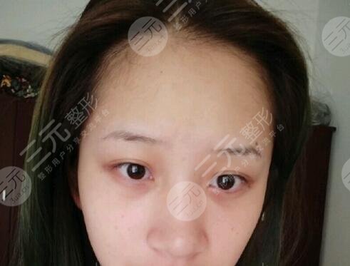 上海九院整形案例分享前