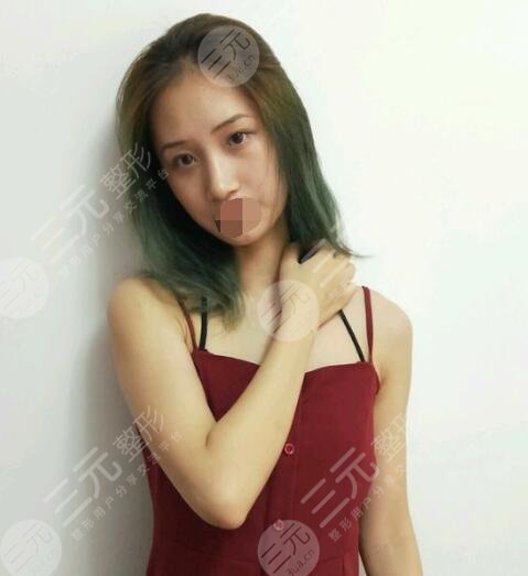 上海九院整形案例分享后